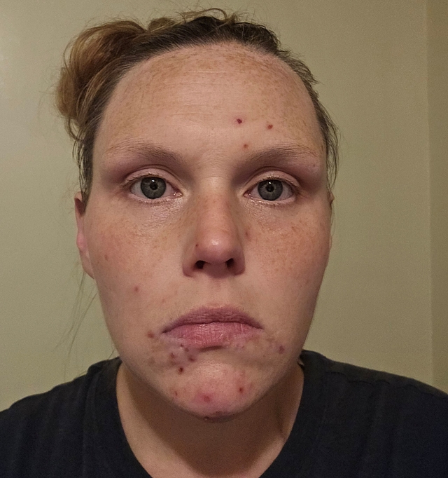 Alyssa C., 34 Before