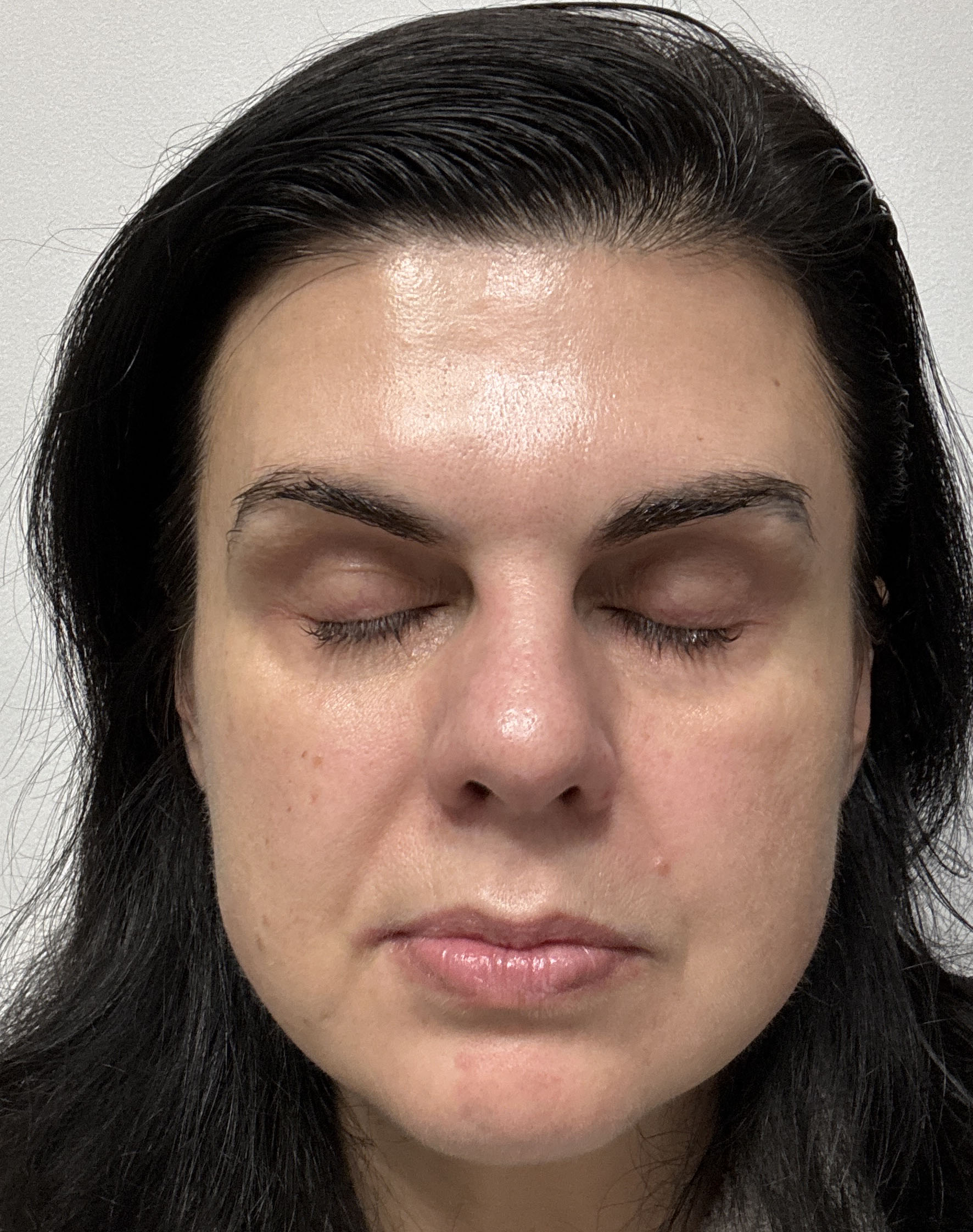 Halyna M., 46 After