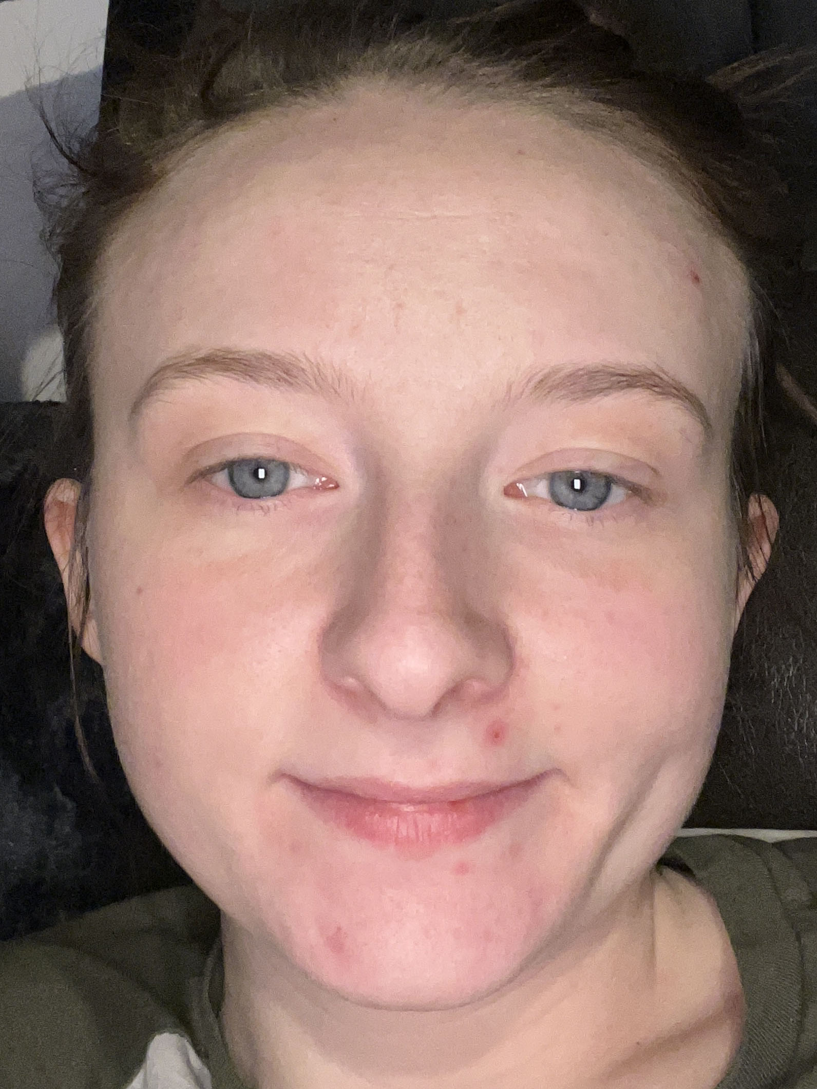 Victoria H., 25 After